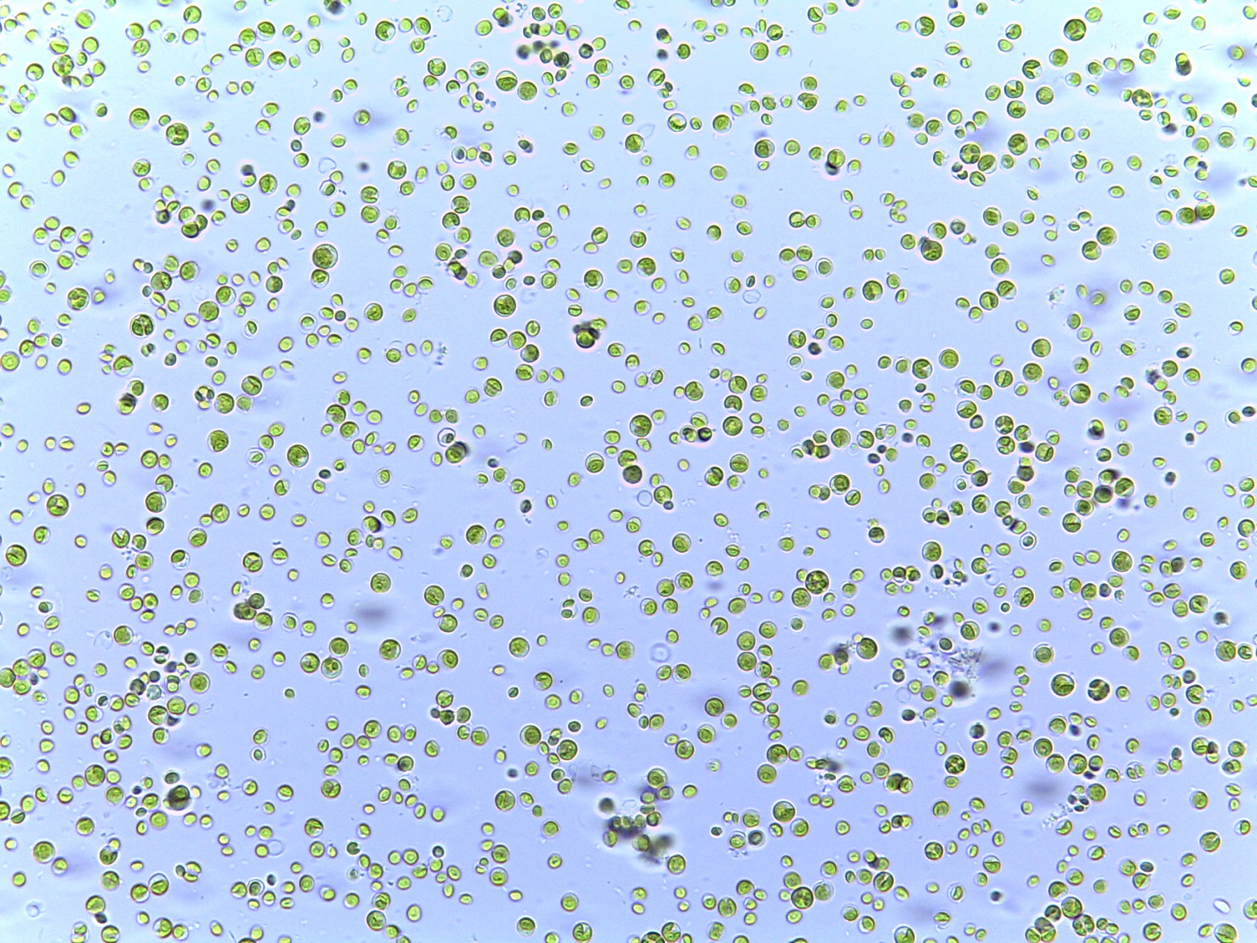 Chlorella vulgaris cells, little green dots